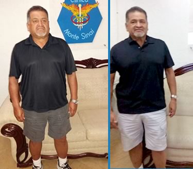 Clinica para Adelgazar para Hombres