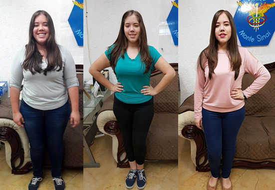 Como Adelgazar Rápido