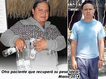 Clinica para Adelgazar para Hombres