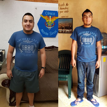 Clinica para Bajar de Peso