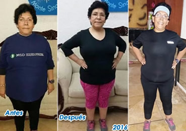 Como Adelgazar Rápido