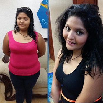 Clinica para Bajar de Peso