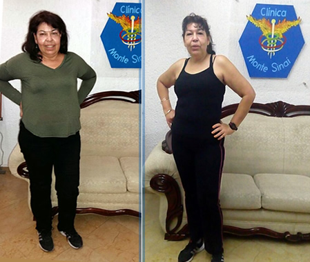 Como Adelgazar Rápido