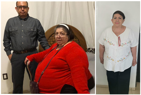 Bajar de Peso Rápido